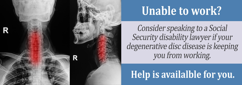 Can I Continue Working with Degenerative Disc Disease?