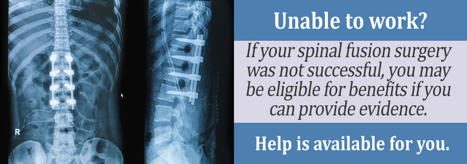 What Is Included in My Disability Application for a Spinal Fusion?