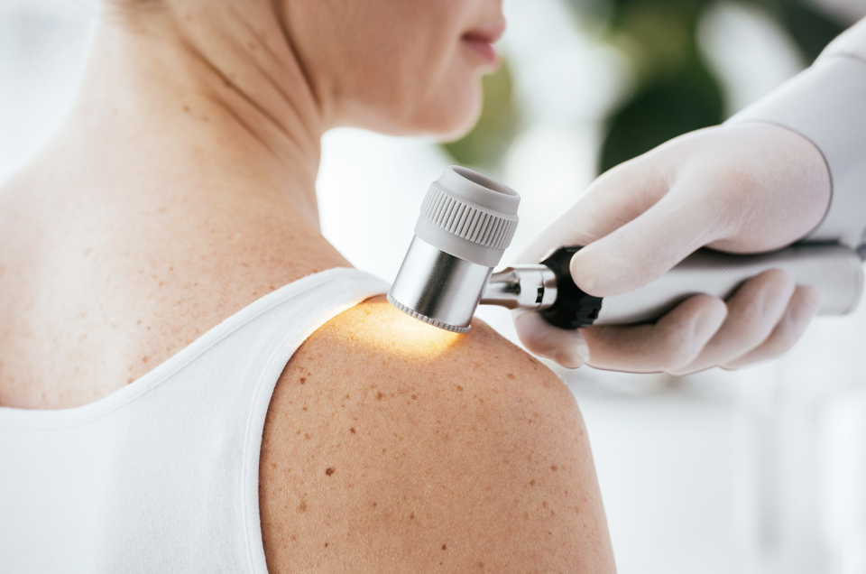 dermatology-skin-check-for-melanoma.png