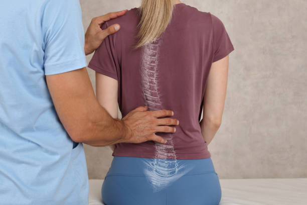 scoliosis-diagnosis-dbh